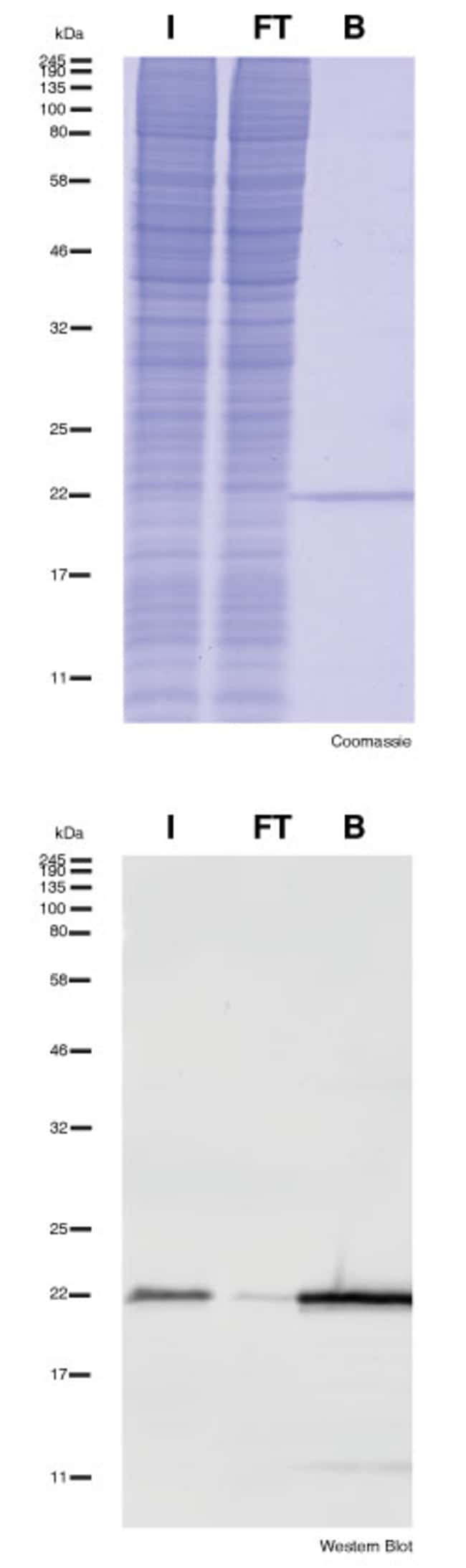 Proteintech&nbsp;Kit de microbilles d’agarose ChromoTek SNAP/CLIP-tag-Trap