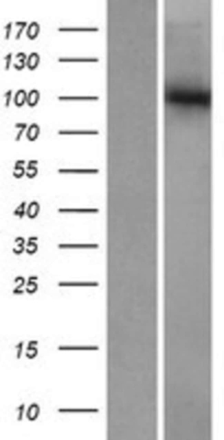 Novus Biologicals&amp;trade;&amp;nbsp;gtf3c3 Overexpression Lysate