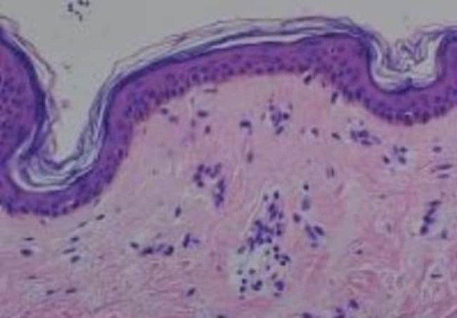 Novus Biologicals&amp;trade;&amp;nbsp;Human Multi-tissue Tissue MicroArray (Normal)