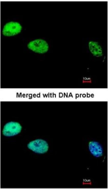 Novus Biologicals&amp;trade;&amp;nbsp;Dlx1 Overexpression Lysate