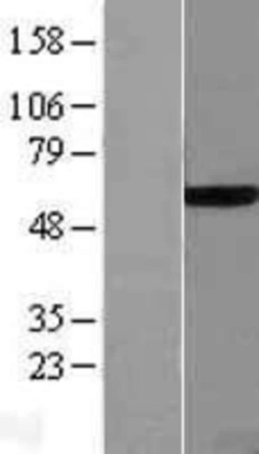 Novus Biologicals&amp;trade;&amp;nbsp;Endothelial Lipase Overexpression Lysate