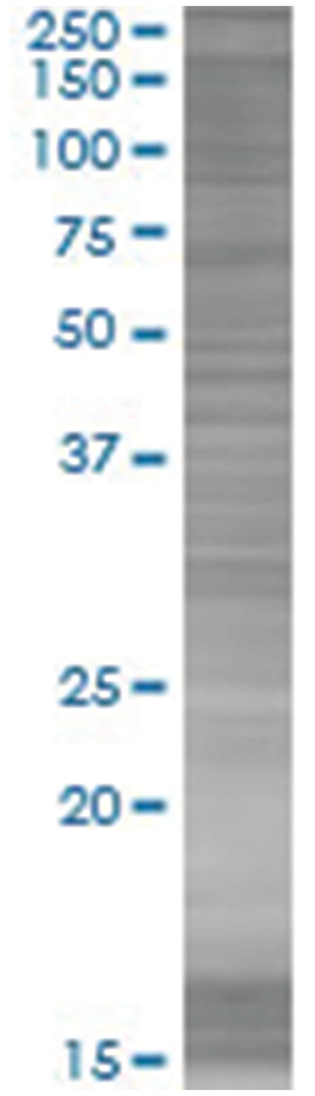 PER1 293T Cell Overexpression Lysate (Denatured), Abnova