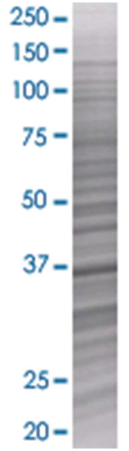 ANXA1 293T Cell Overexpression Lysate (Denatured), Abnova