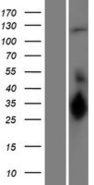 Novus Biologicals&amp;trade;&amp;nbsp;UBE3C Overexpression Lysate