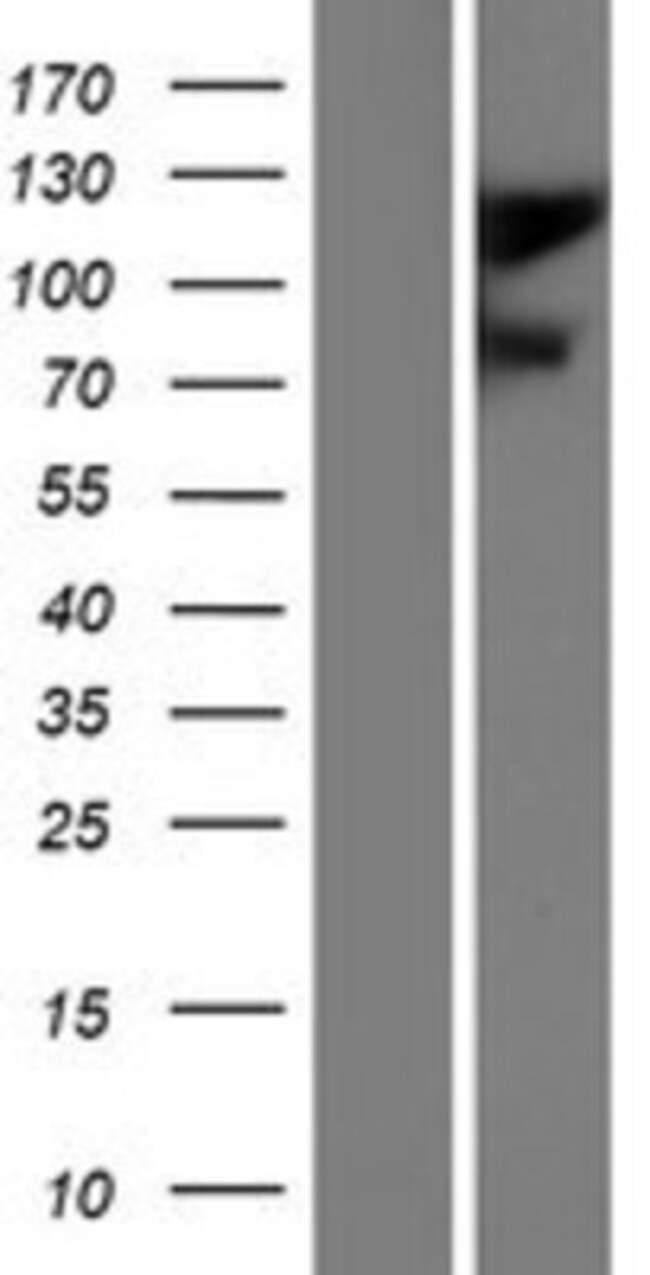 Novus Biologicals™ GluR2 Overexpression Lysate