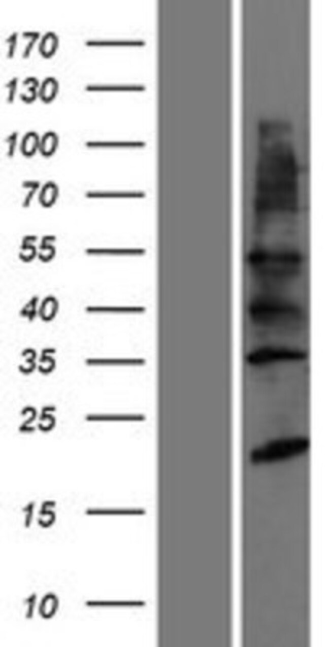 Novus Biologicals™ YIPF2 Overexpression Lysate