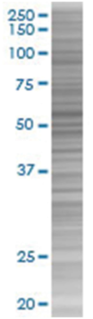 TXNRD1 293T Cell Overexpression Lysate (Denatured), Abnova