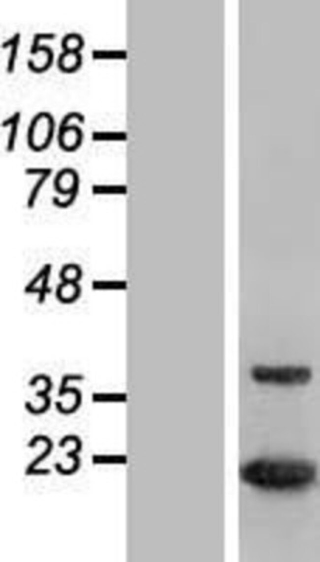 Novus Biologicals™ MTH1 Overexpression Lysate