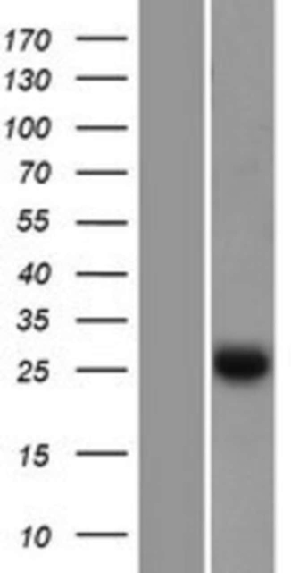 Novus Biologicals&amp;trade;&amp;nbsp;EFHD2 Overexpression Lysate