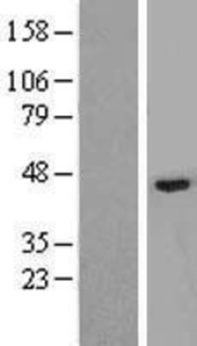 Novus Biologicals™ TBX10 Overexpression Lysate