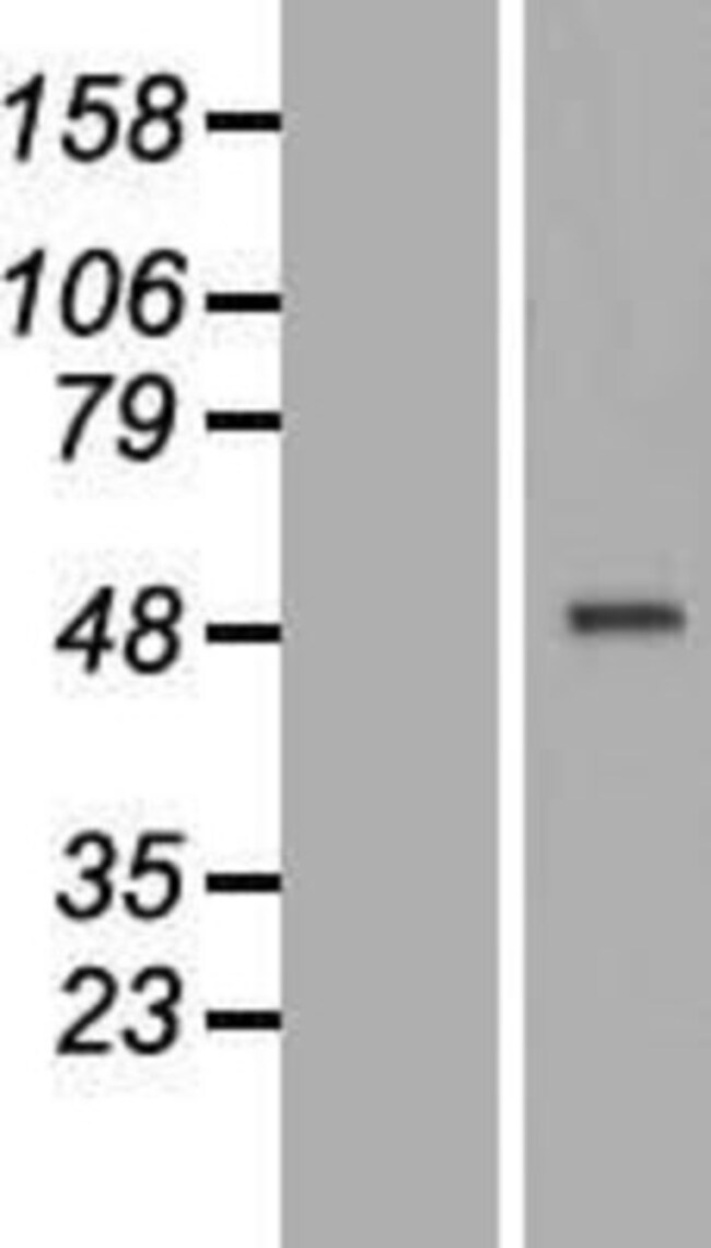 Novus Biologicals™ CRELD1 Overexpression Lysate