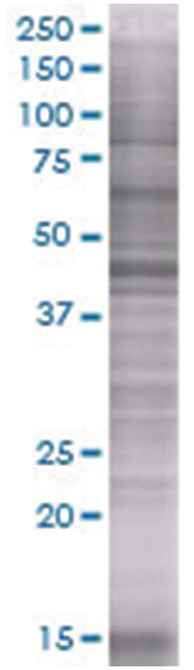 TUBE1 293T Cell Overexpression Lysate (Denatured), Abnova