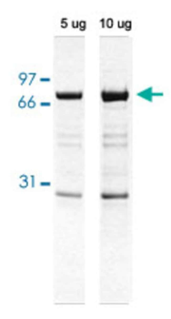 Abnova&amp;trade;&amp;nbsp;Human CAPN1 (P07384) native Protein from human