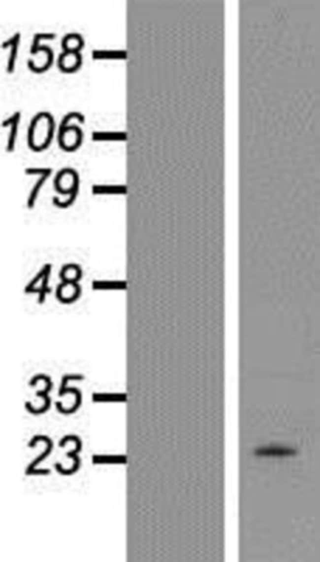 Novus Biologicals™ LIGHT/TNFSF14 Overexpression Lysate