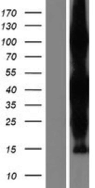 Novus Biologicals&amp;trade;&amp;nbsp;ZC3HAV1L Overexpression Lysate