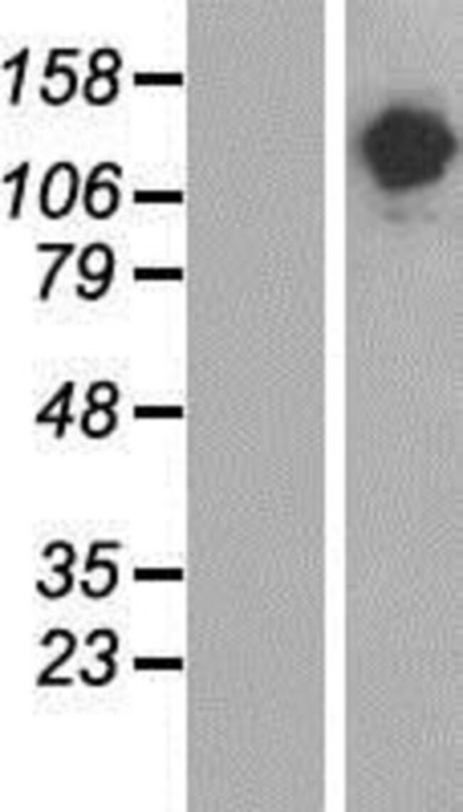 Novus Biologicals™ SALF Overexpression Lysate