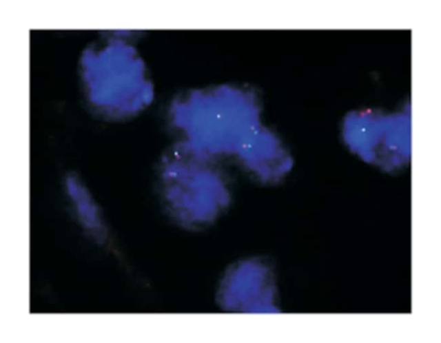 Abnova&amp;trade;&amp;nbsp;Sonde FISH de fragmentation TFE3