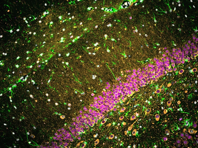 Proteintech&trade;&nbsp;FlexAble CoraLite&trade; Plus 550 Antibody Labeling Kit for Mouse IgG1