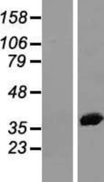 Novus Biologicals&amp;trade;&amp;nbsp;Annexin A2 Overexpression Lysate