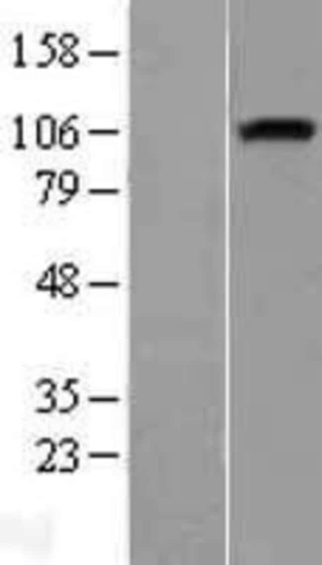 Novus Biologicals™ Neuropilin-1 Overexpression Lysate