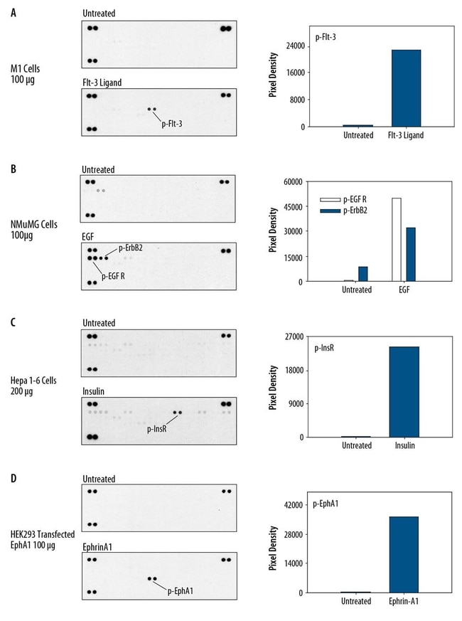 R&amp;D Systems&trade;&nbsp;Proteome Profiler Mouse Phospho-RTK Array Kit