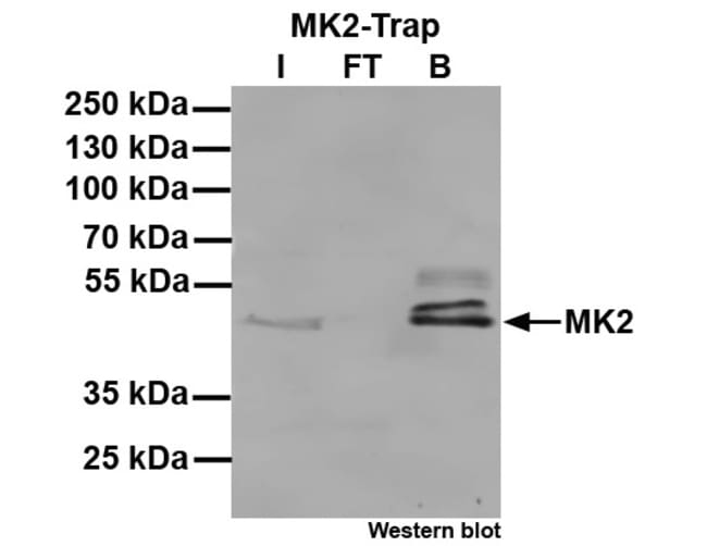 Proteintech&nbsp;Kit d’agarose ChromoTek MK2-Trap