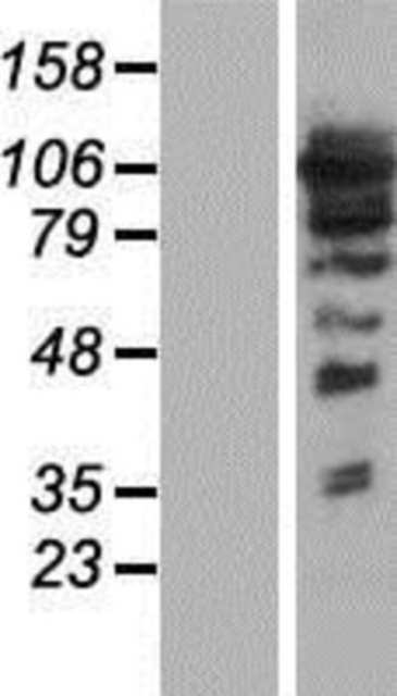 Novus Biologicals&amp;trade;&amp;nbsp;ARHGEF1 Overexpression Lysate