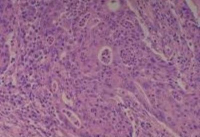 Novus Biologicals&trade;&nbsp;Human Multi-tissue Tissue MicroArray (Cancer)