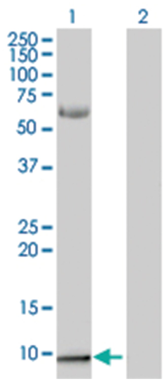 S100A2 293T Cell Overexpression Lysate (Denatured), Abnova