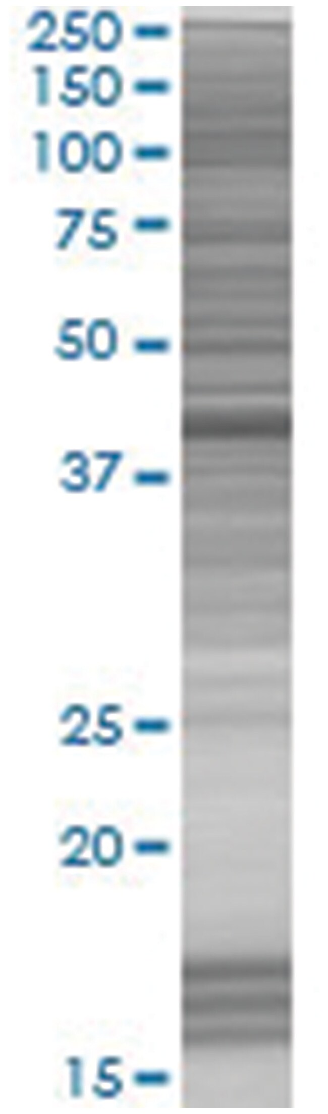 SORBS3 293T Cell Overexpression Lysate (Denatured), Abnova