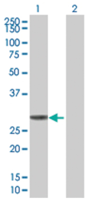 KHK 293T Cell Overexpression Lysate (Denatured), Abnova