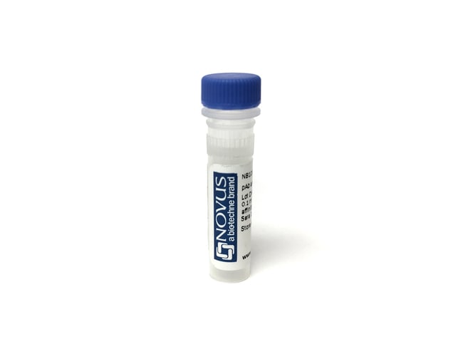 Novus Biologicals™ GPT Native Protein