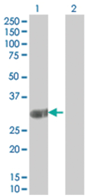 ING2 293T Cell Overexpression Lysate 1 (Denatured), Abnova