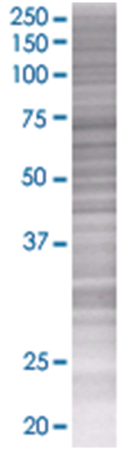 APRIN 293T Cell Overexpression Lysate (Denatured), Abnova