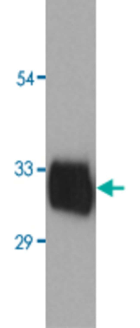 Abnova&amp;trade;&amp;nbsp;Human KLK3 native Protein from human seminal plasma