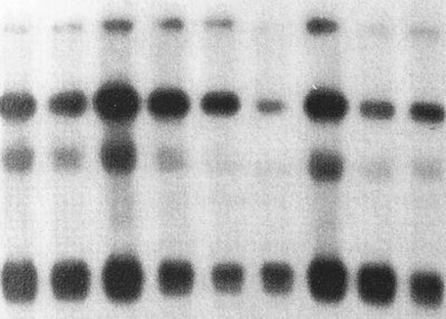 Cytiva&amp;nbsp;Système de marquage de l’ADN Amersham&amp;trade; Rediprime II