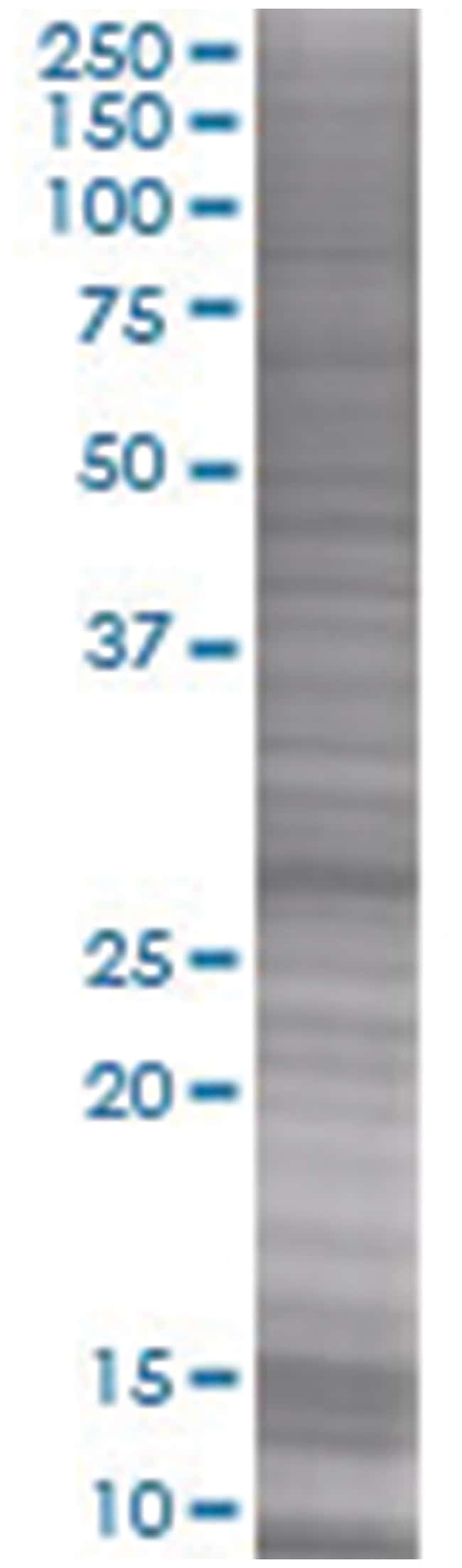 RAB23 293T Cell Overexpression Lysate 1 (Denatured), Abnova