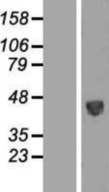 Novus Biologicals&amp;trade;&amp;nbsp;PSG5 Overexpression Lysate