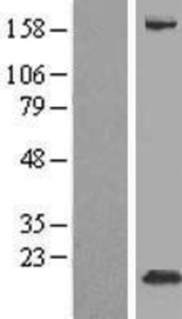 Novus Biologicals&amp;trade;&amp;nbsp;FXYD3 Overexpression Lysate