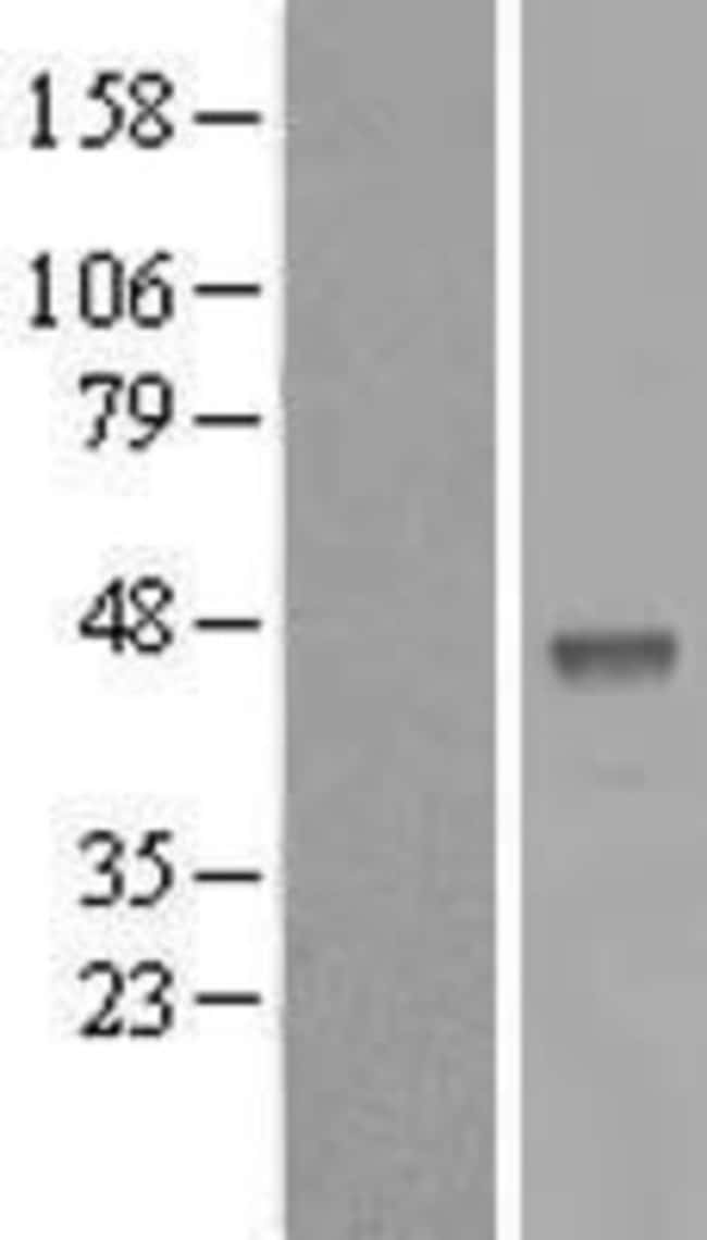 Novus Biologicals™ B3GALT5 Overexpression Lysate