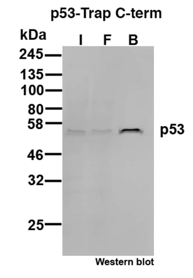 Proteintech&nbsp;Kit d’agarose ChromoTek p53 C-term-Trap