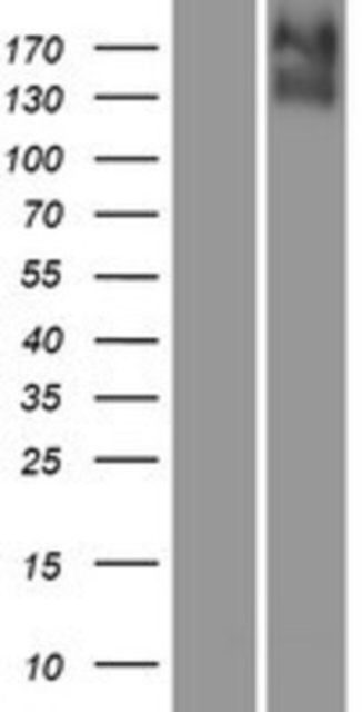 Novus Biologicals&amp;trade;&amp;nbsp;KCC4/SLC12A7 Overexpression Lysate