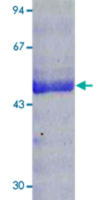 Abnova&amp;trade;&amp;nbsp;Human MMP1 native Protein from human fibroblasts