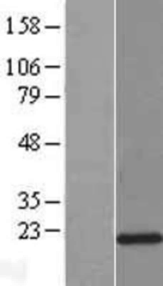 Novus Biologicals™ LCN8 Overexpression Lysate