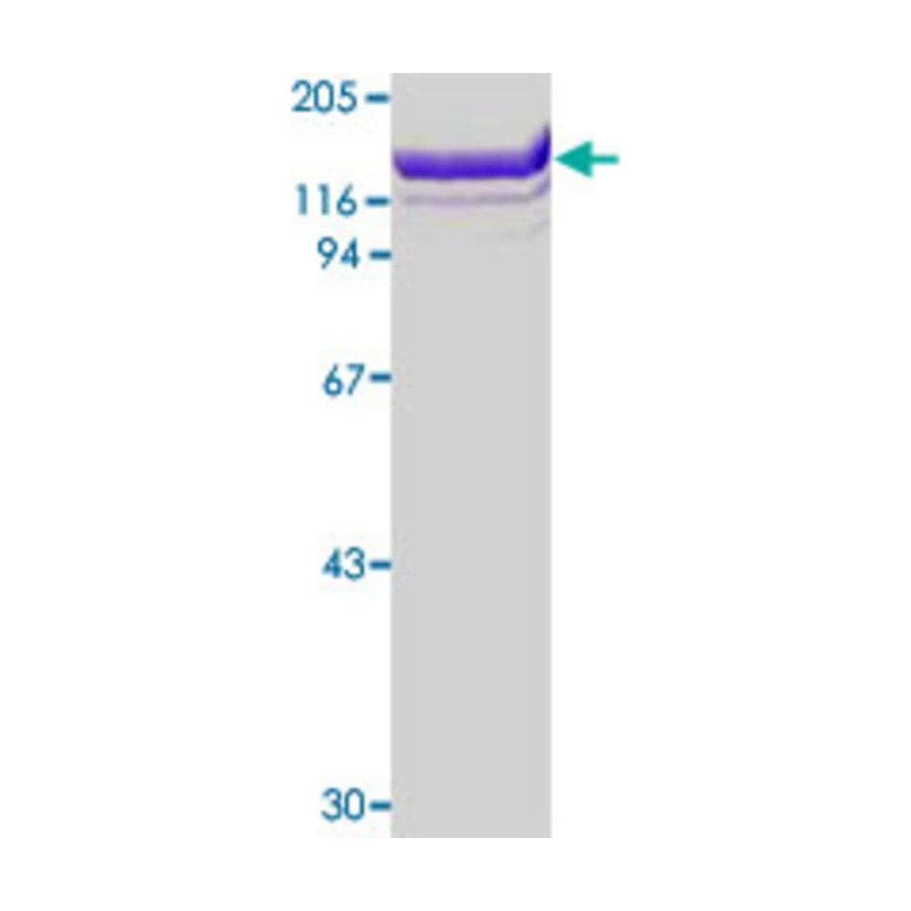 Abnova&trade;&nbsp;Human ANPEP (967 amino acids) native Protein from human serum