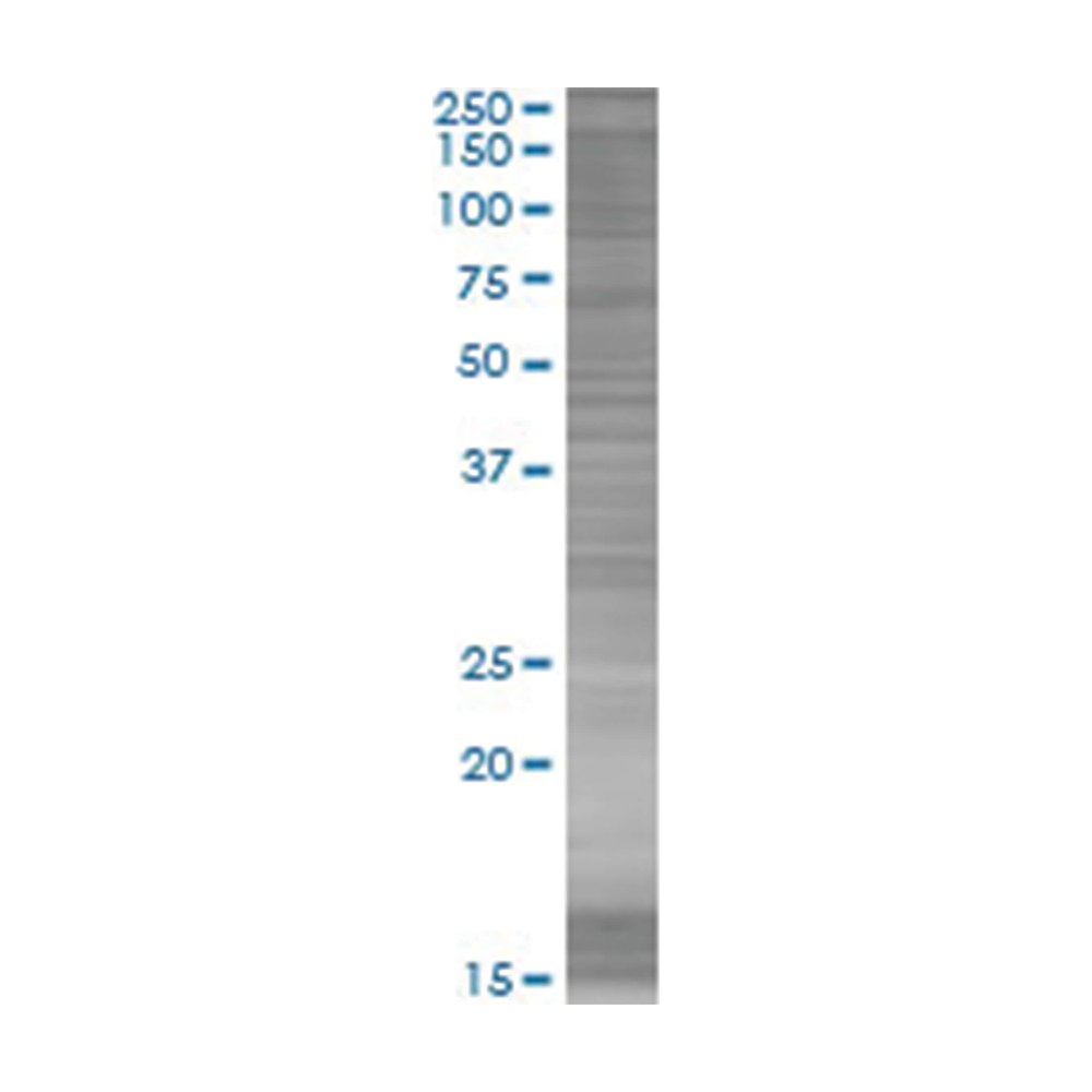 Lysat de surexpression PER1 en cellules 293T (dénaturé), Abnova
