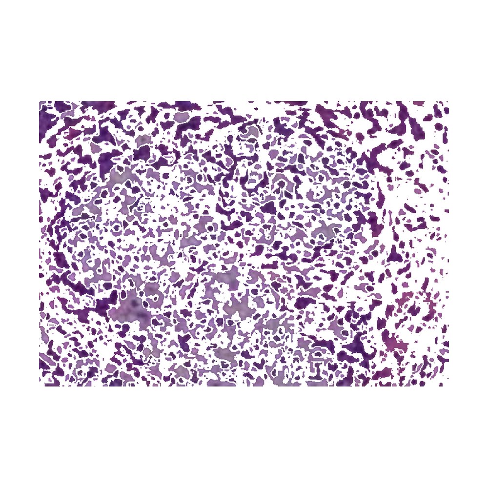 Novus Biologicals&trade;&nbsp;Micro-réseau de tissus (TMA) humains multi-tissus (cancer)
