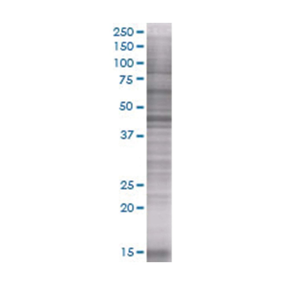 Lysat de surexpression TUBE1 en cellules 293T (dénaturé), Abnova