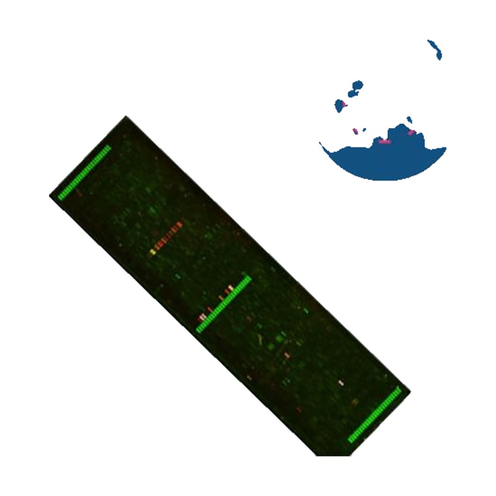 PEPperCHIP&trade;&nbsp;Microarray d’antigènes de virus d’Epstein-Barr