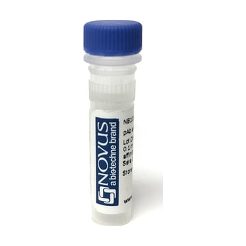 Novus Biologicals&trade;&nbsp;beta Galactosidase Native Protein